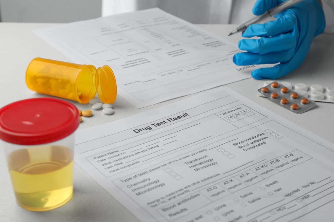 drug test