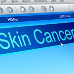 how much is a skin cancer check