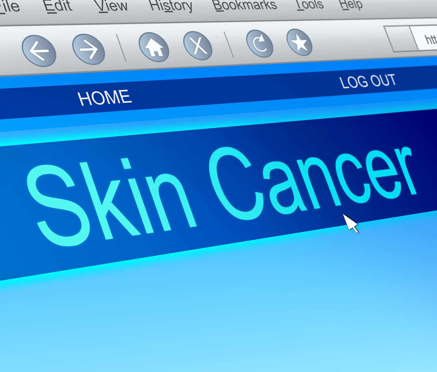 how much is a skin cancer check