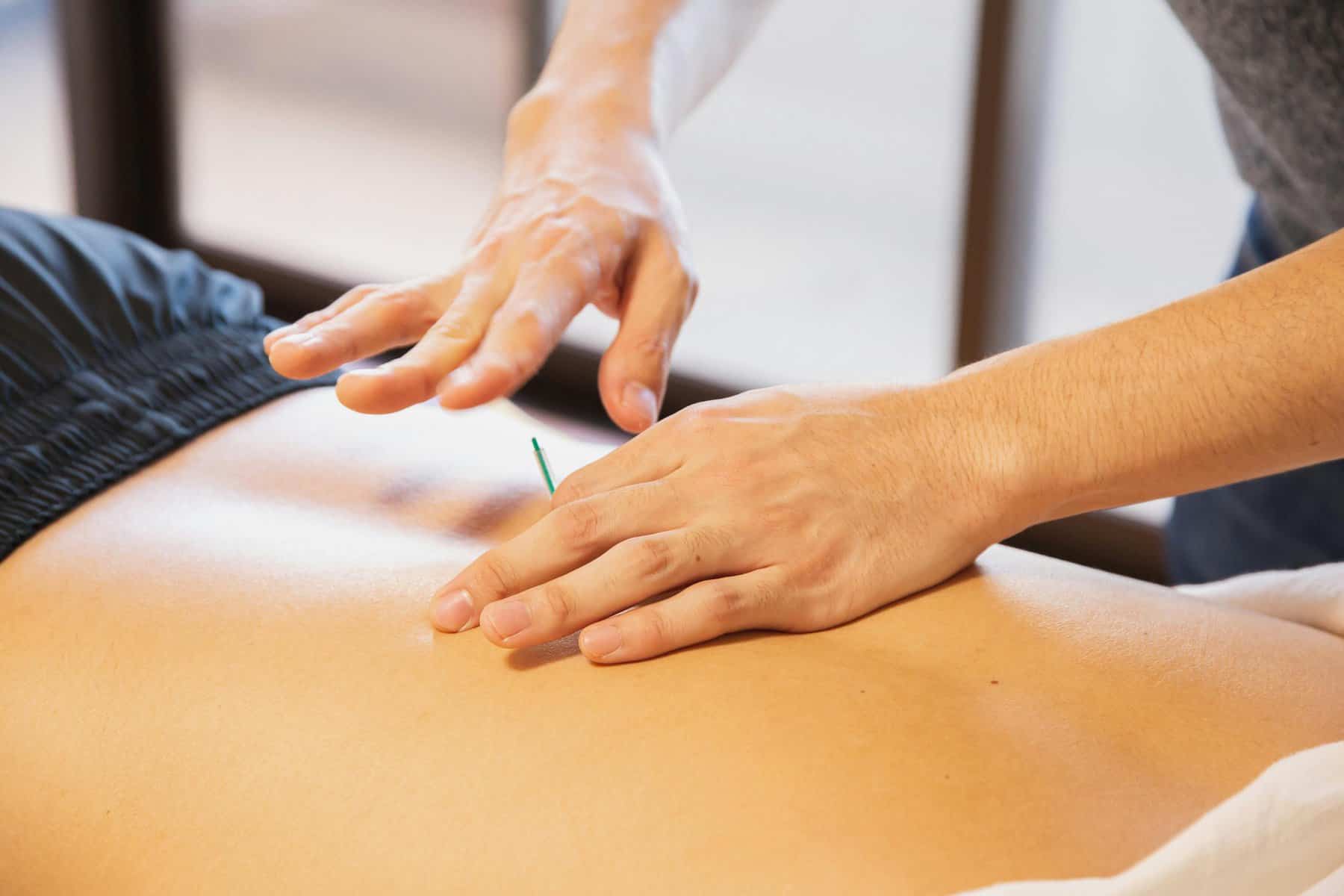 How Much Does It Cost For Acupuncture: A Quick Guide