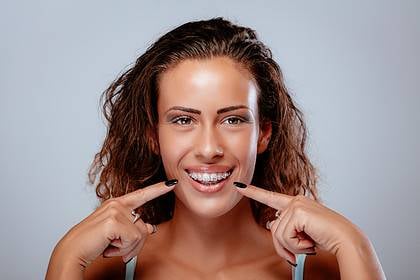 Woman smiling and pointing to her braces, dental cost concept.