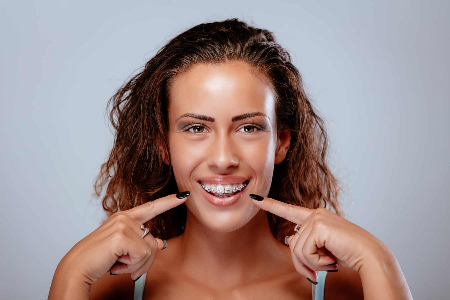 Woman smiling and pointing to her braces, dental cost concept.